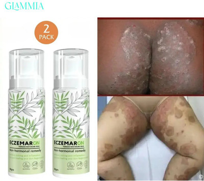 CHIWA Eczmaron Anti Fungal Cream | Skin Recovery Balm For Sensitive Areas(100 g)
