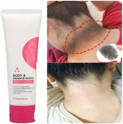 Latixmat Body & Private Parts Whitening Cream for girls ,women(100 g)