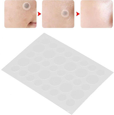 MYEONG Acne Pimple Patches For All Skin Types(3 g)