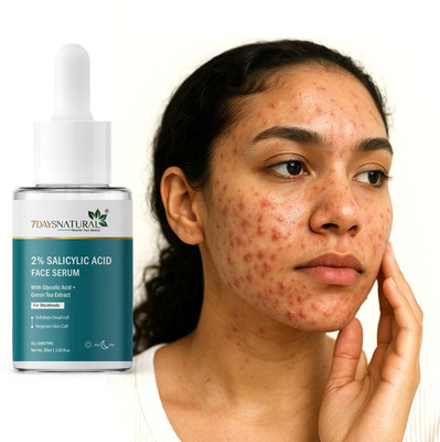 7days natural Salicylic Acid Serum for Acne, Pimples | Oil Control | Reduces Blackheads | Whiteheads & Breakouts | Pore Cleansing gives smoother, clearer, and more even-toned skin(30 ml)