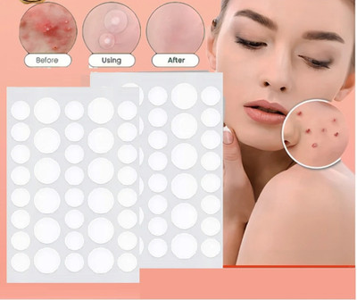 tanvi27 Acne Pimple Patch-Invisible Facial Dots(10 g)