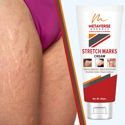METAVERSE Nourish and hydrate your skin with our enriching stretch marks cream(100 g)