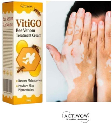 ACTIWOW Vitigo Bee Venom Cream for Gentle Pore Control(100 g)