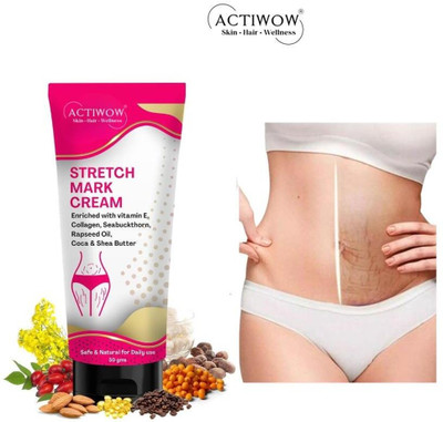 ACTIWOW Stretch Marks Removal Cream, Scalp‑Safe Formula CM01(50 g)