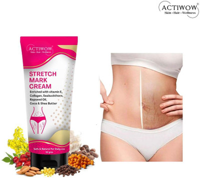 ACTIWOW Stretch Marks Removal Tube For, Lightweight Mark Fix CM01(50 g)