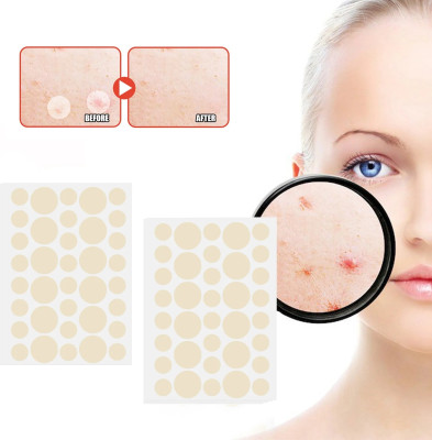 tanvi27 Nose Acne Pimple Patch(10 g)