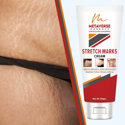 METAVERSE Experience the difference with our premium stretch marks cream(100 g)