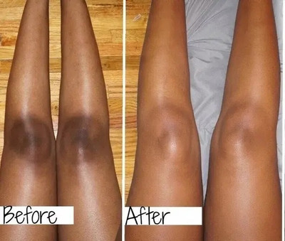 GFSU - GO FOR SOMETHING UNIQUE Bikini Lines Intimate Area Skin Moisturize Softens Cream(50 g)