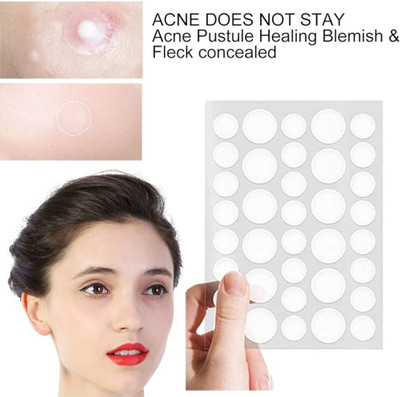 FLORERO Patches for Face Acne Scars Pimple Patches(20 g)