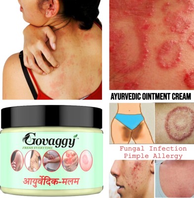 Govaggy Ayurveda Ointment Fungal Malam For Ringworm, Itching & Skin Treatment, Skin Care Cream (pk1)(25 g)