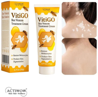 ACTIWOW Vitigo Bee Venom Cream for Blemish Smoothing Cream(100 g)