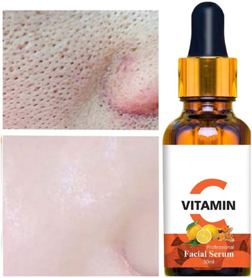 GFSU - GO FOR SOMETHING UNIQUE Advance Vitamin C Radiance Booster Anti acne serum(30 ml)