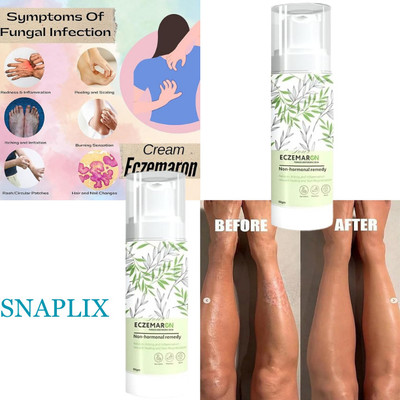 Snaplix Eczemaron VelvetGlow | Smooth Radiance for Skin Relief(100 ml)