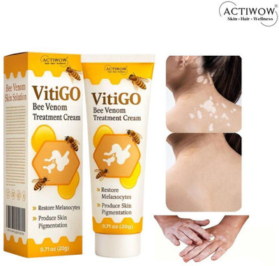 ACTIWOW Vitigo Bee Venom Cream for Soft Skin Texture cream(100 g)