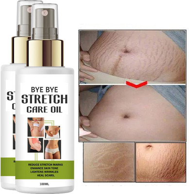 Jasoliya Stretch Oil Duo – 2PCS Bye Bye Stretch & Wrinkle Oil – 100ml Bottles(100 ml)