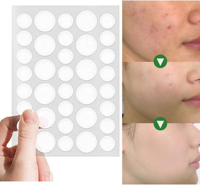 FLORERO New Face Acne Pimple Patch, Invisible, Blemish Spot(20 g)