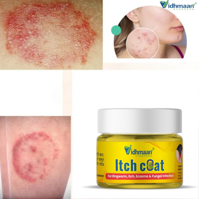 vidhmaan ayurveda Ringworm Ayurvedic ItchCoat Anti fungal Malam for Ringworm, itching, Eczema cream (fungal remove cream | Quick Relief itching cream(25 g)