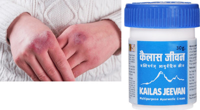 kailas jeevan Ayurvedic Multipurpose Cream for Chilblains | Herbal Soothing Ointment for Swelling, Redness & Itching | Natural Cooling Relief | 30g(30 g)