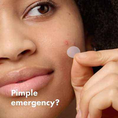 Latixmat Acne Pimple Patches Absorbs Pimple Overnight, Reduces Excess Oil For All Skin Types(5 g)