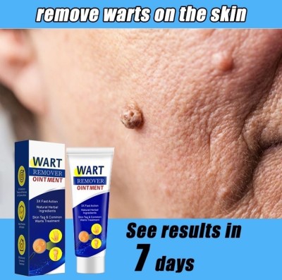 manasona New Warts Remover Antibacterial Ointment Wart Treatment Cream(100 g)