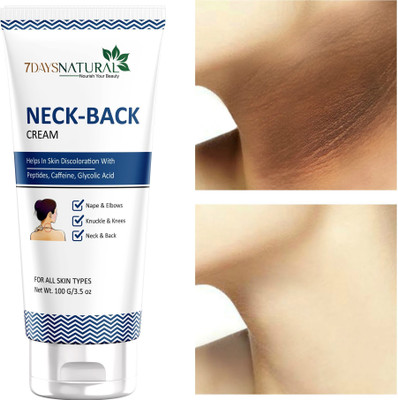 7days natural Dark Neck Back Whitening Cream For Dark Neck Ankles Knuckles Elbows Underarm(100 g)
