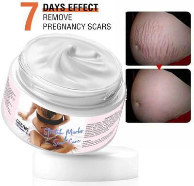 luzimaisa Natural Stretch Marks Scar removal cream(50 g)