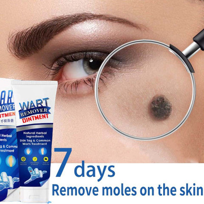 manasona Wart Remover Cream, Massa Removal Cream(100 g)