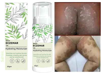 sahini Eczema Relief Cream with Herbal Extracts(50 g)