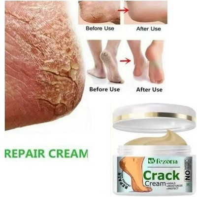 FEZONA Ultimate Solution Rough Crack Heel Repair Cream for Moisturizes and Soothes Feet(100 g)
