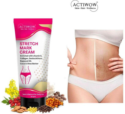 ACTIWOW Stretch Marks Removal Tube For, For Smoother Skin(50 g)