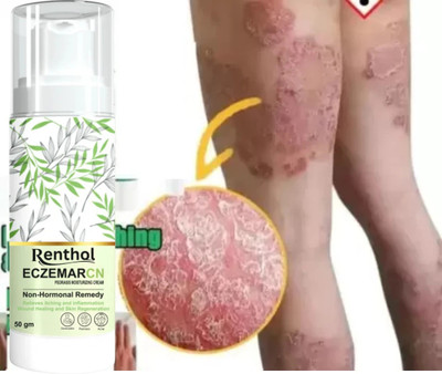 Renthol Eczemaron Fungal Cream For Men & Women Ayurvedic ItchCoat Anti fungal Malam for Ringworm itching Eczema cream (PACK - 1)(50 g)
