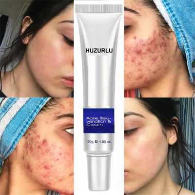 HUZURLU Moisturizing Acne Cream(30 g)