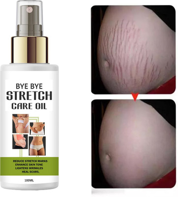 vcn Bye Bye Stretch Oil – Skin Rejuvenation & Stretch Mark Remedy – 100ml(100 ml)
