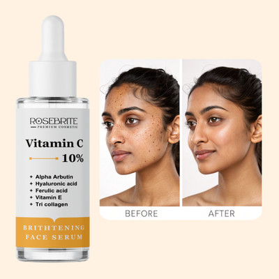 RoseBrite Triple Action Vitamin C Serum – Brightens, Fades Pigmentation & Boosts Collagen for Firmer, More Even-Toned Skin(30 ml)