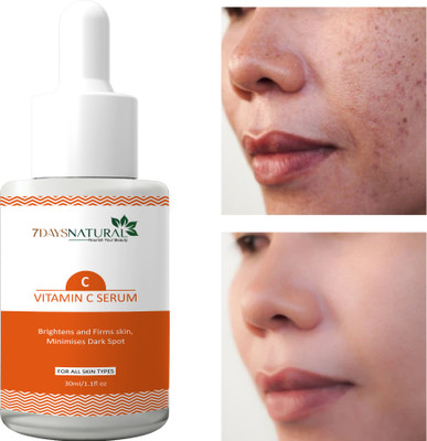7days natural Vitamin C Face Serum - Skin Brightening Reduce dark spot, Pigmentation, Blemishes Removal serum(30 ml)