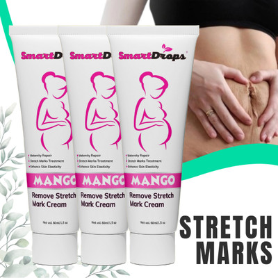 smartdrops Stretch Mark & Scar Removal Cream for Pregnancy to Reduce Stretch Marks & Scars(180 ml)