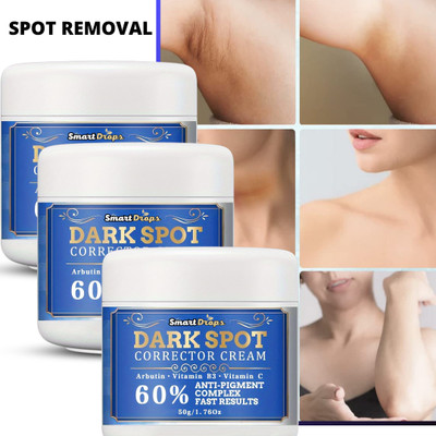 smartdrops Dark Spot Reduction Cream || Non Greasy Moisturizer Cream With UV Protect|(150 g)