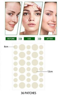 tanvi27 Acne Pimple Patch(10 g)