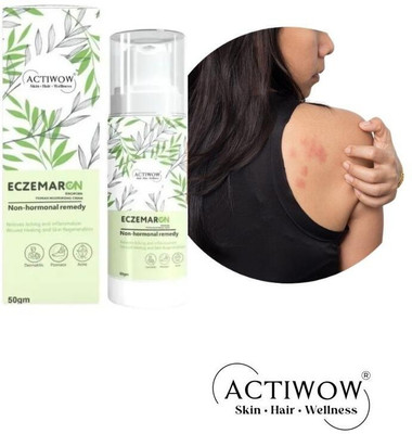 ACTIWOW Eczemaron Anti Fungal Cream – Gentle Touch CM01(50 g)
