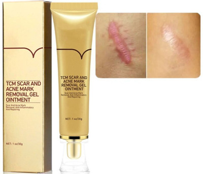 Flawls HNS Scar & Acne Mark Remover Cream – Safe & Effective(30 g)
