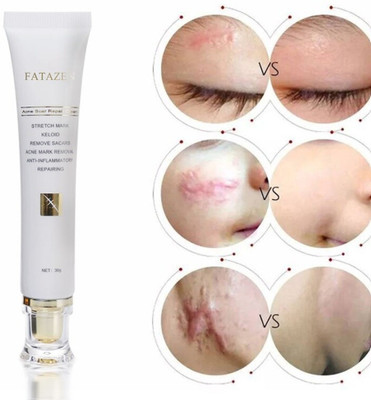 CHYLVY GO Advanced Acne Spot Scar Corrector Cream Clear Skin Formula(30 g)