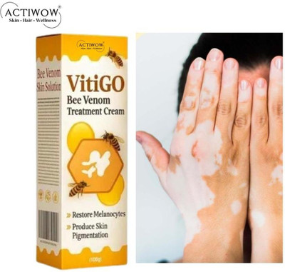 ACTIWOW Vitigo Bee Venom Cream for Rapid Patch Soothing cream(100 g)