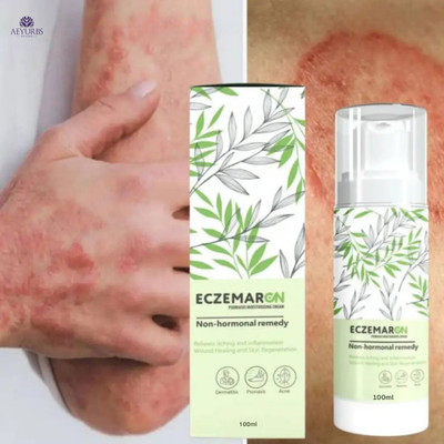 AEYURBS Eczemarcn Anti Fungal Cream | Calms And Restores Eczema Damaged Skin(100 ml)