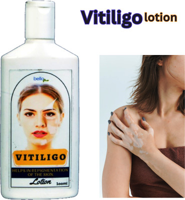 BelloMe vitiligo skin healing lotion | | vitiligo skin discoloration oil cream | vitiligo skin discoloration cream | vitiligo skin whitening lotion(100 ml)
