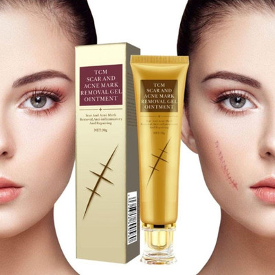 Flawls HNS Scar & Acne Remover Cream for Face & Body(30 g)