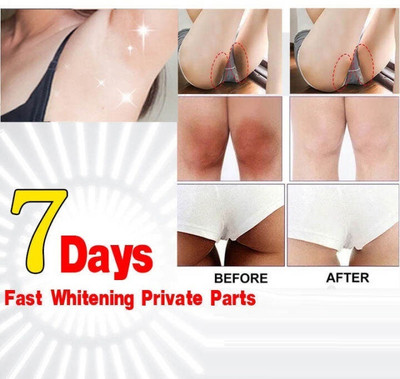 Gabbu Korean Intimate Bikini Area Private Part Whitening Brightening Lightening Cream Men & Women(50 g)