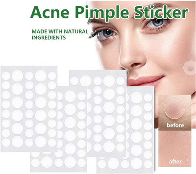 tanvi27 Acne Pimple Patch Spot Clearing(20 g)