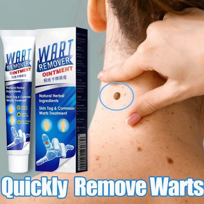 manasona Wart Remover Cream ,Suitable for Men and Women(100 g)