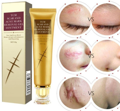 Flawls HNS Anti-Scar & Acne Removal Cream for Smooth Skin(30 g)