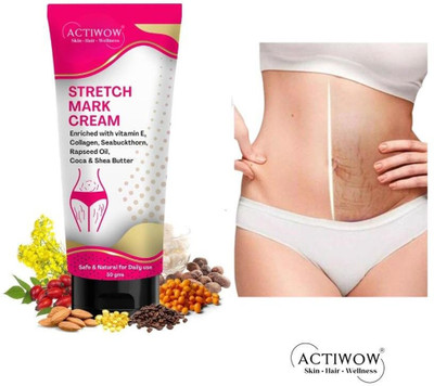 ACTIWOW Stretch Marks Removal Tube For, Barrier Boost Formula CM01(50 g)